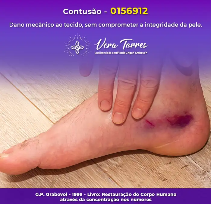 Contusão – 0156912