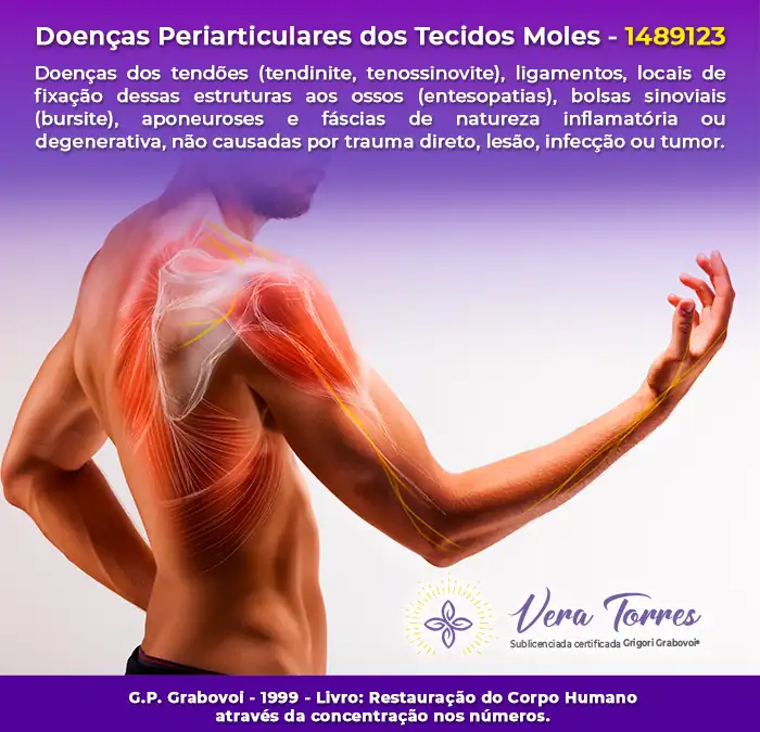 Doenças Periarticulares dos Tecidos Moles – 1489123