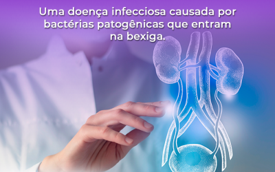 Cistite (Infecção na Bexiga) – 48543211