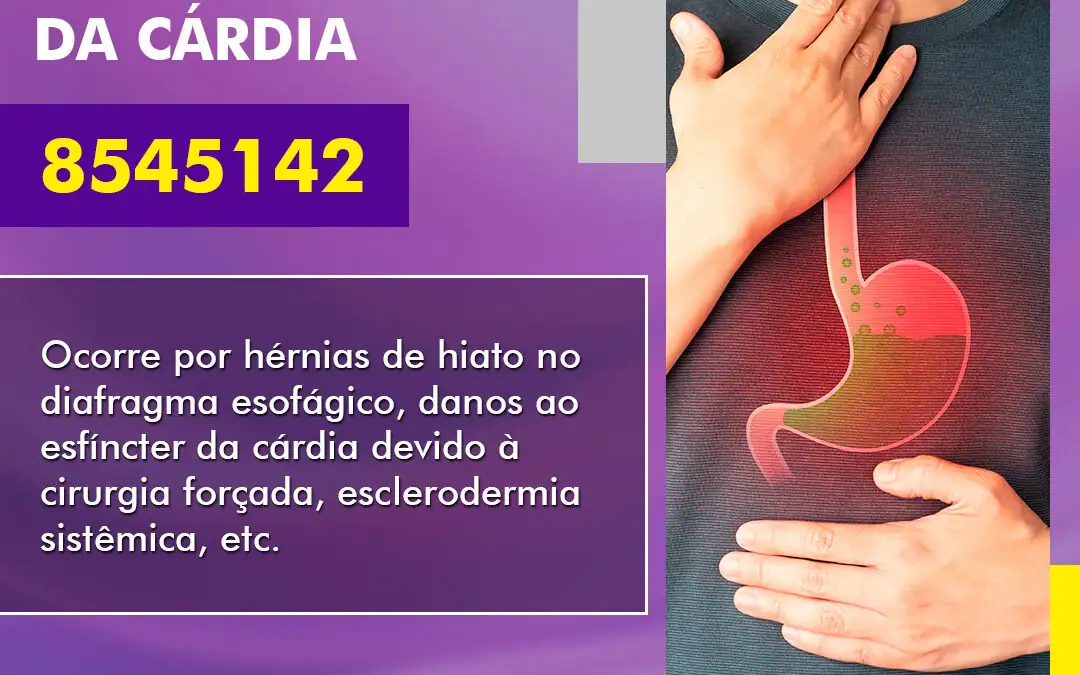 Insuficiência do Esfíncter Cardíaco – 8545142